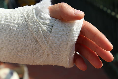 Hand nach einer Verletzung, Nachbehandlung in der Handtherapie
