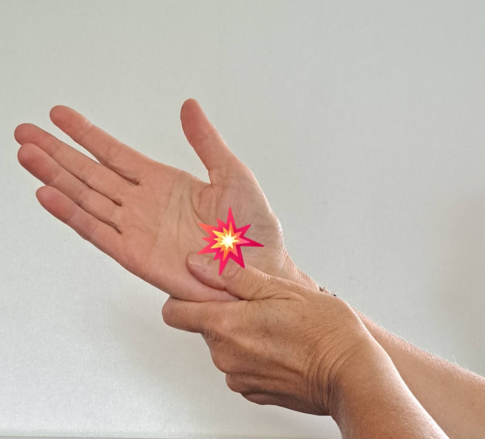Hand mit markiertem Schmerzpunkt bei Karpaltunnelsyndrom